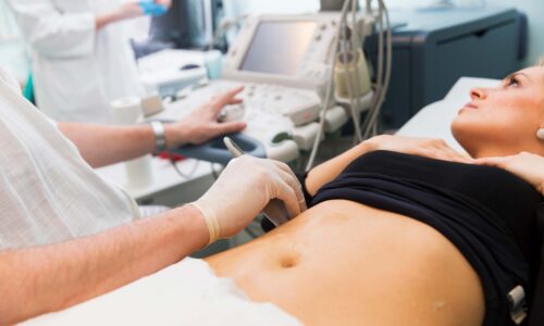 Ультразвуковое исследование Ультразвуковое исследование