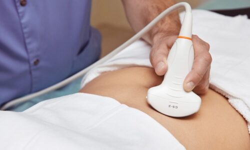 ультразвуковое исследование мочевого пузыря ультразвуковое исследование мочевого пузыря