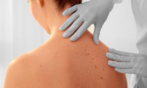 диагностика токсико-аллергических дерматитов