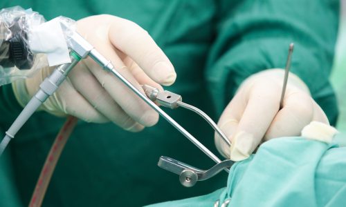 хорошая биопсия яичка