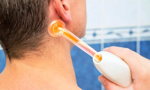 показания к проведению дарсонвализации