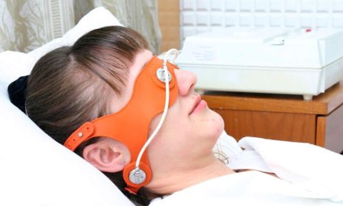 процедура электросон