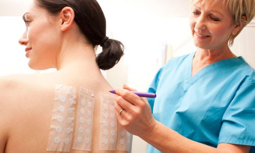 возникновения аллергических реакций возникновения аллергических реакций