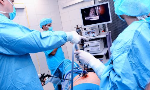 Профессиональная лапароскопия