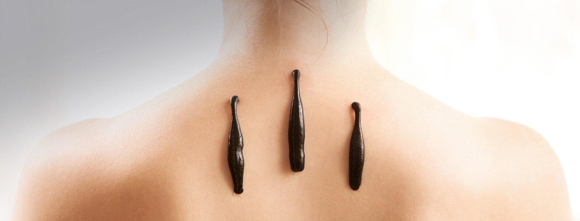 эффективна гирудотерапия при воспалительных процессах 