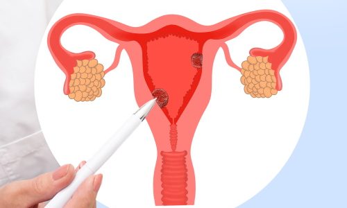 Своевременно проведенная операция