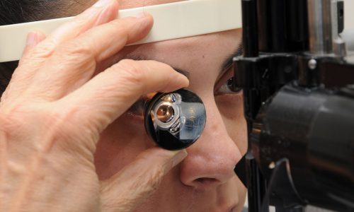 качественная Гониоскопия качественная Гониоскопия