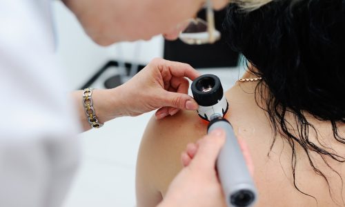 качественная дерматоскопия кожи