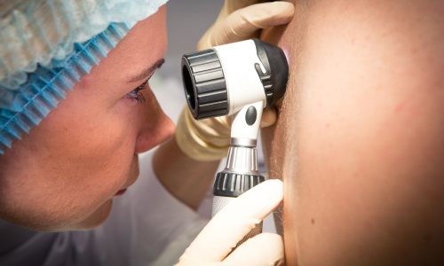 качественное лечение базалиомы качественное лечение базалиомы