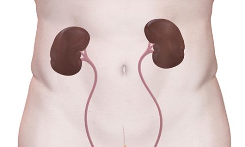 проведения операций при раке мочеточника проведения операций при раке мочеточника