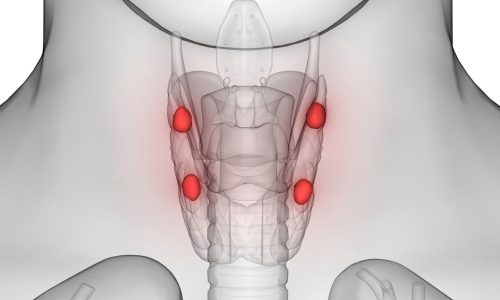 вмешательство под наркозом вмешательство под наркозом
