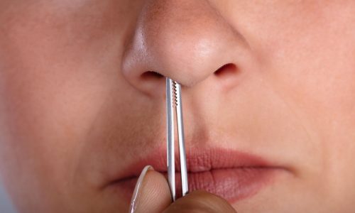 Безопасное удаление инородного тела из носа Безопасное удаление инородного тела из носа