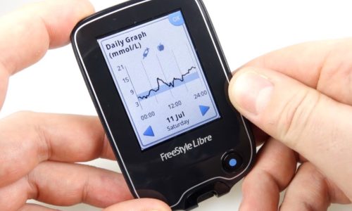 Качественный непрерывный мониторинг глюкозы