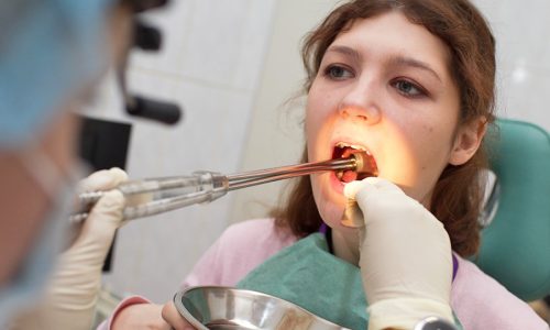 Профессиональная увулопалатопластика Профессиональная увулопалатопластика