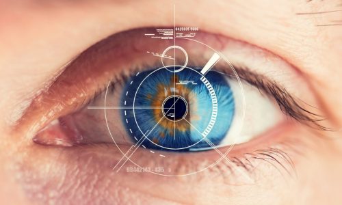качественная Оптическая биометрия глаз качественная Оптическая биометрия глаз