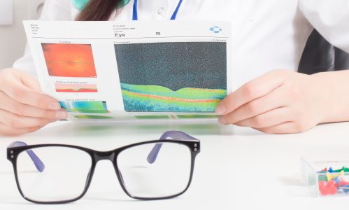 качественное Исследование цветоощущения