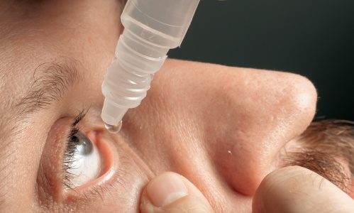 качественноей Струйное промывание конъюнктивальной полости