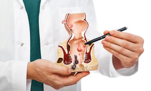 показания к проведению тромбэктомии показания к проведению тромбэктомии