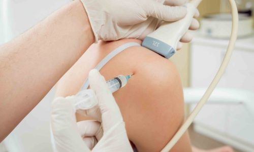 качественное Лечение суставов плазмой крови качественное Лечение суставов плазмой крови